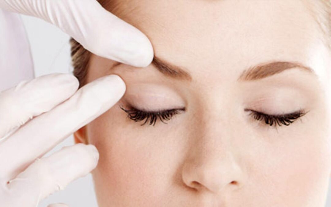 Ανόρθωση Φρυδιών (Brow Lift)